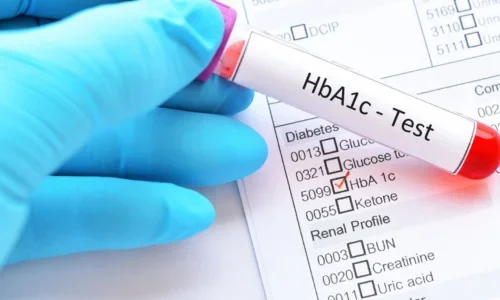 HBA1C Test