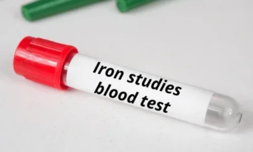 Iron Studies Test