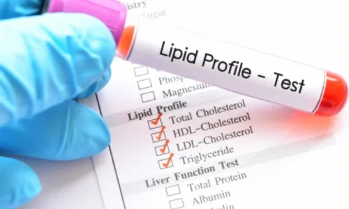 Lipid Profile Test