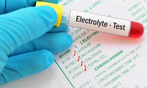 S. Electrolyte Test