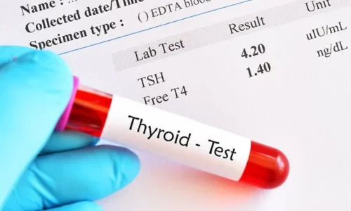 Thyroid Test