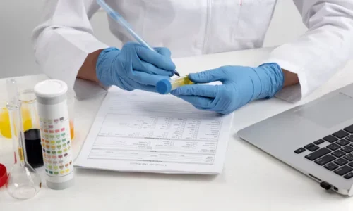 Urine RM Test