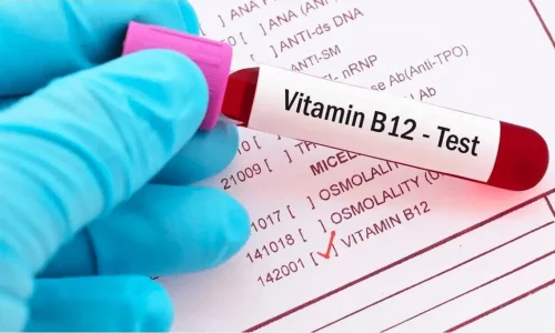 Vitamin-B12Test