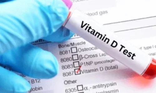 Vitamin D Test (1)
