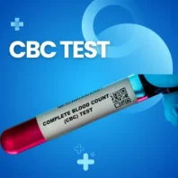 cbc test